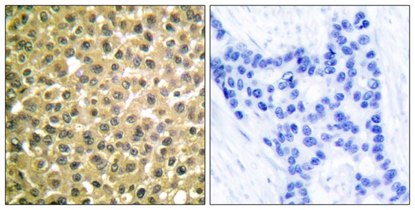 Retinoic acid receptor beta Ab