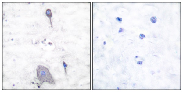 SHP substrate 1 Ab