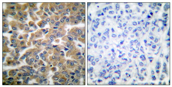 Glucocorticoid receptor Ab