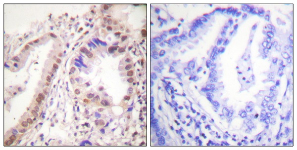 Estrogen receptor Ab