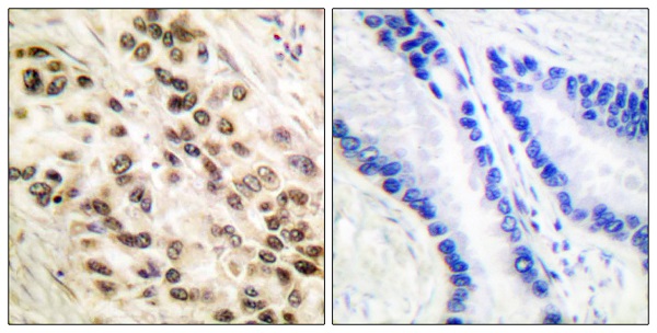 CEBP beta Ab