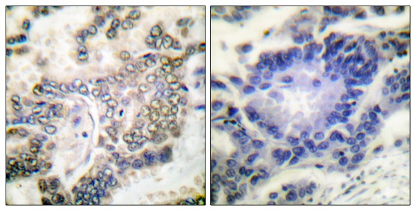 CEBP alpha Ab