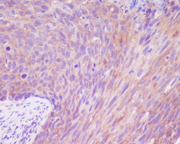 Desmoglein 1 Ab