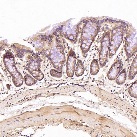 Cadherin 2 Ab