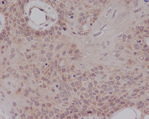 Estrogen receptor Ab