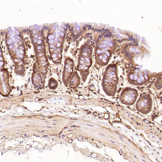 EGFR Ab