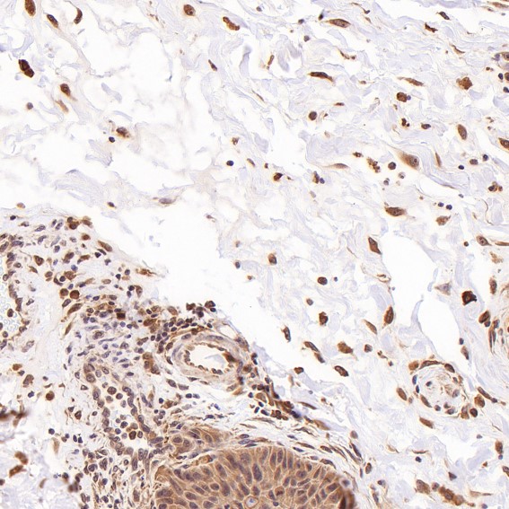 Heme Oxygenase 1 Ab