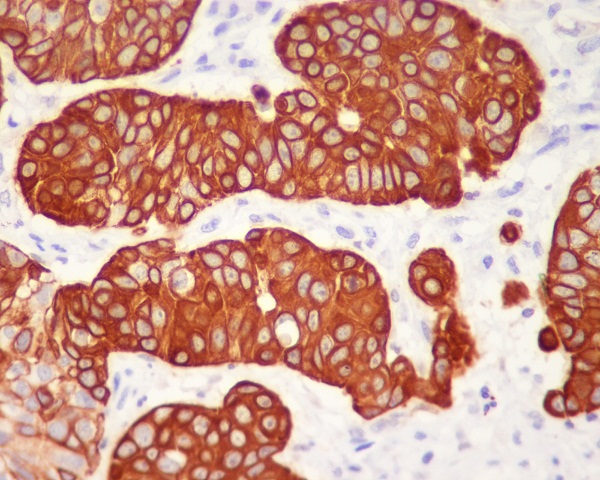 Cytokeratin 5 Ab