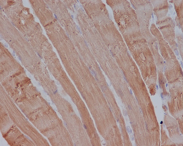 alpha Skeletal muscle actin Ab