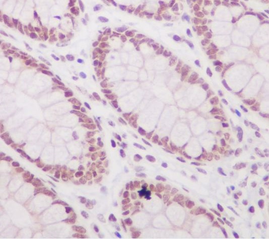 Acetyl-Histone H3 (K57) Ab