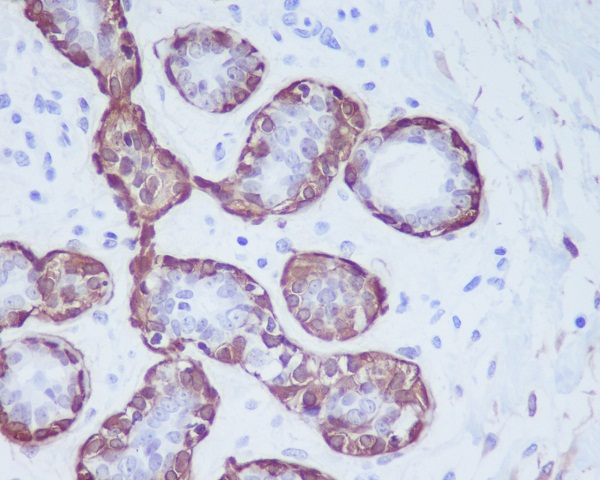 Calponin 1 Ab