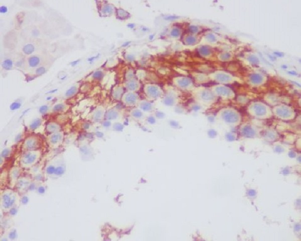 Integrin beta 3 Ab