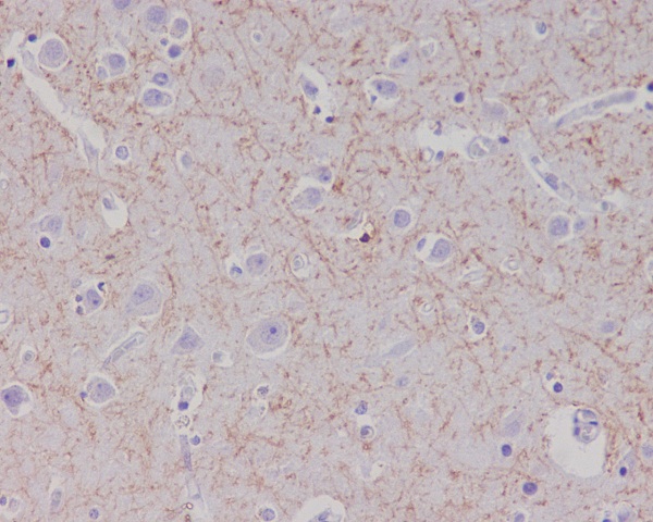 Amyloid beta A4 Ab