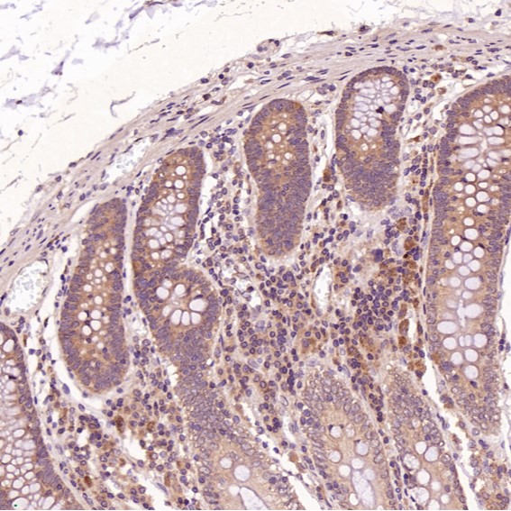 Cleaved-PARP 1 (D214) Ab