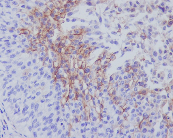 Thrombomodulin Ab