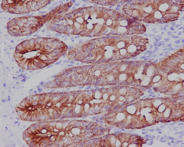 Cytokeratin 19 Ab