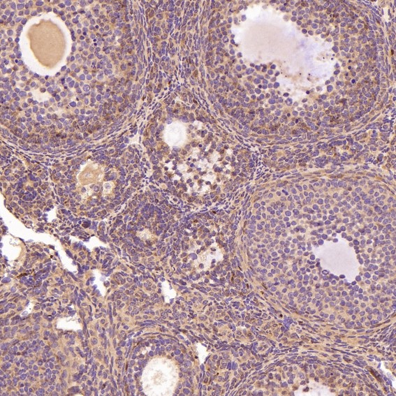 Glutamine synthetase Ab