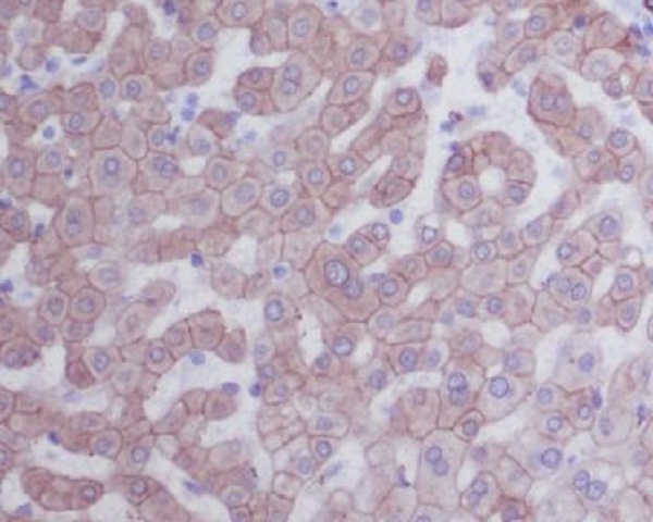 Cytokeratin 8 Ab