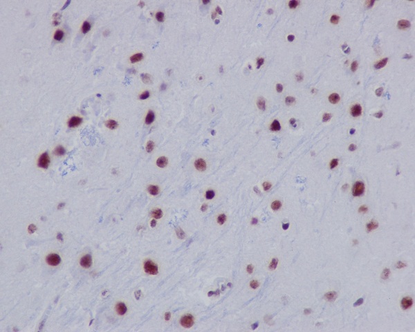 Acetyl-Histone H2A (K9) Ab