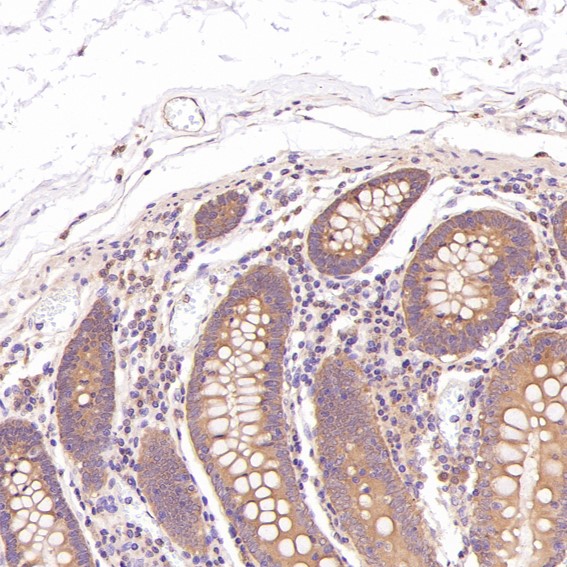 Cleaved-Caspase 3 p17 Ab