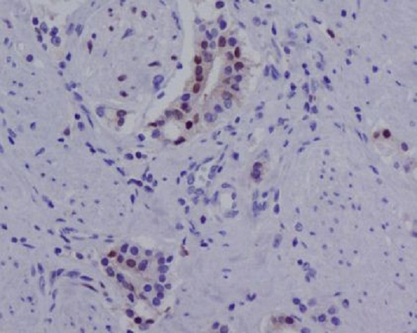 Androgen receptor (AR3 specific) Ab