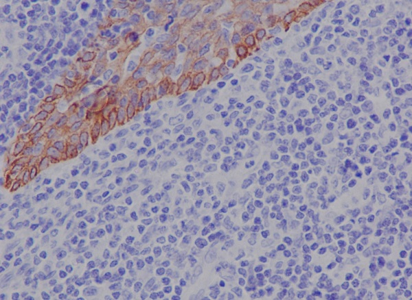 Cytokeratin 17 Ab