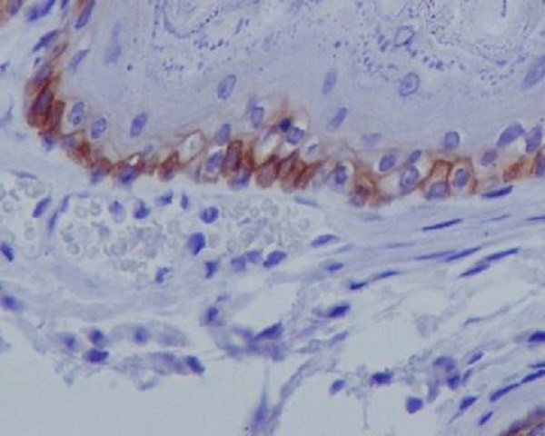 Collagen XVII alpha 1 Ab