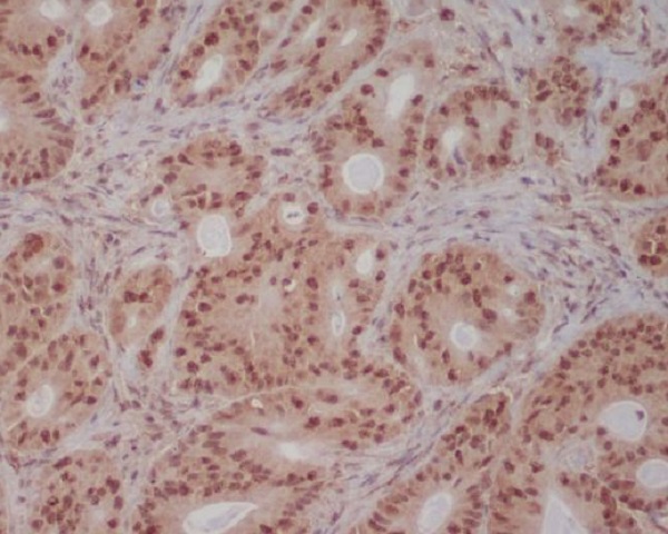 PI3 kinase p85 beta Ab