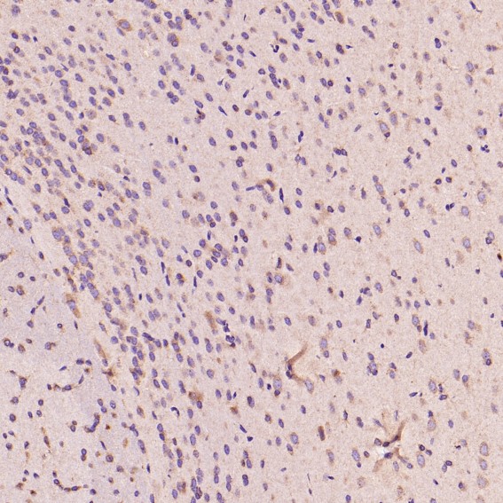 CD8 alpha Ab