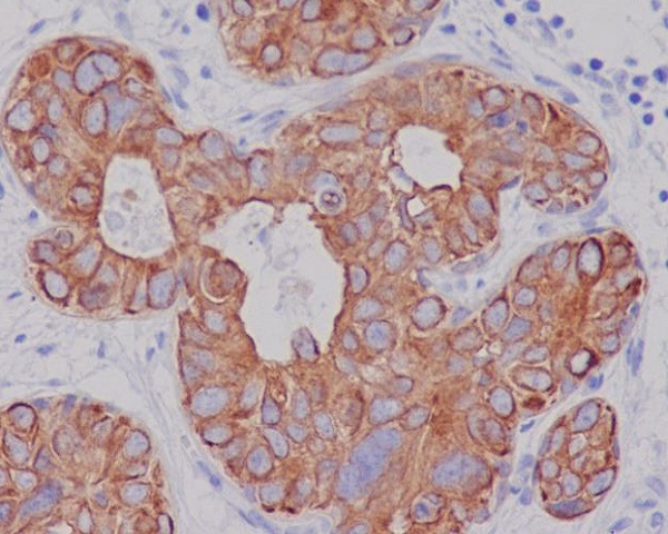 Cytokeratin 7 Ab