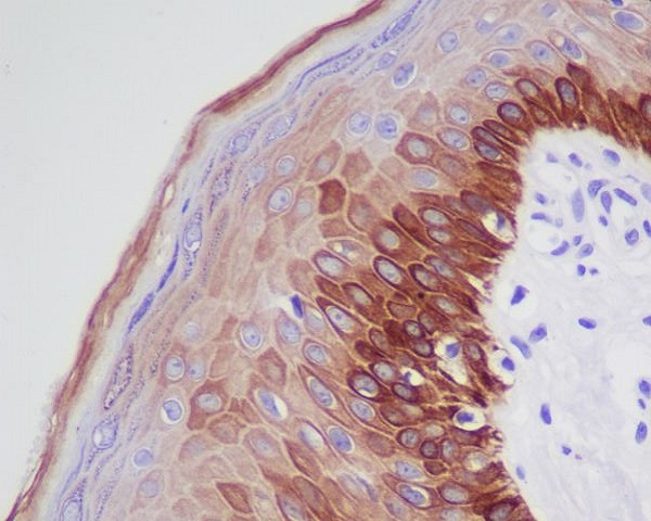 Cytokeratin 16 Ab