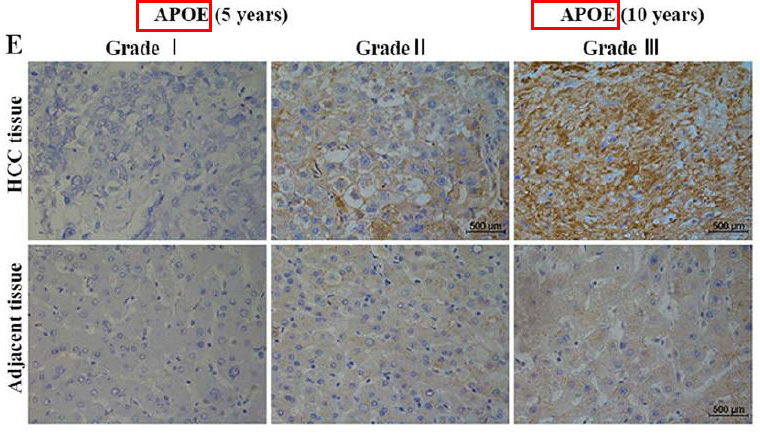 Apolipoprotein E Ab