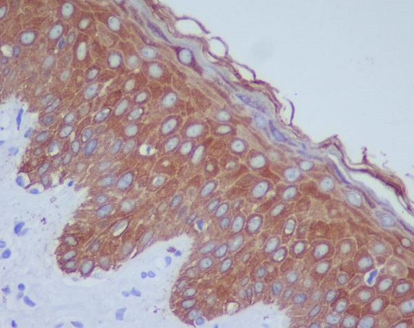 Cytokeratin 14 Ab