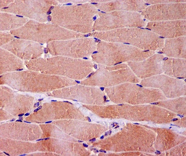 Myoglobin Ab