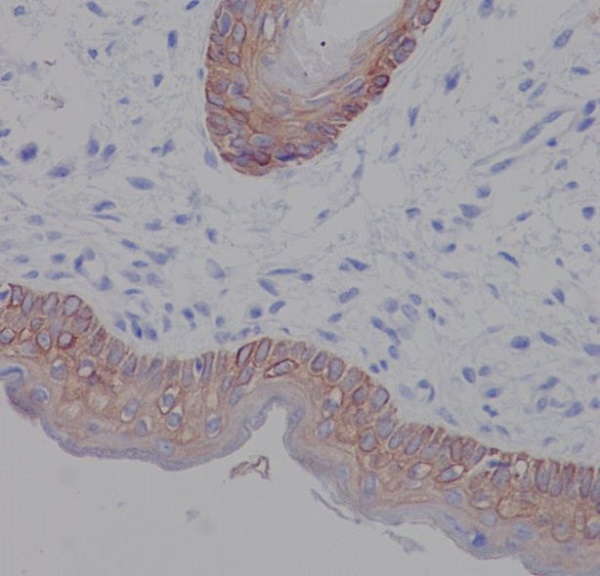 Cytokeratin 5 Ab