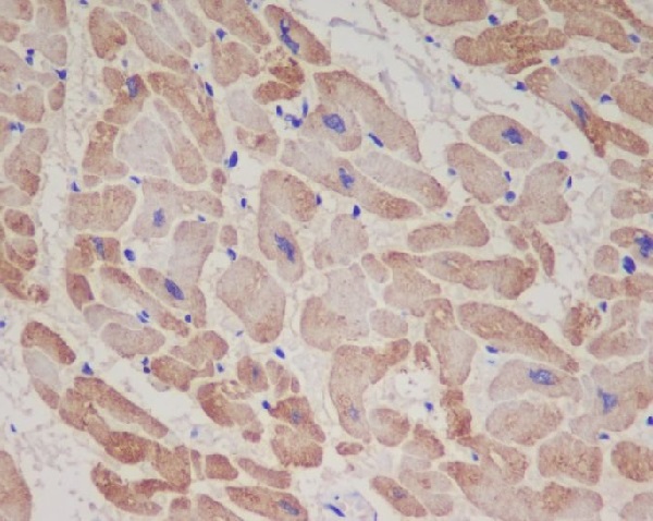 Troponin T Ab