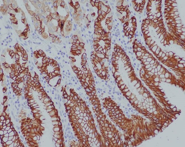 Cytokeratin 14 Ab