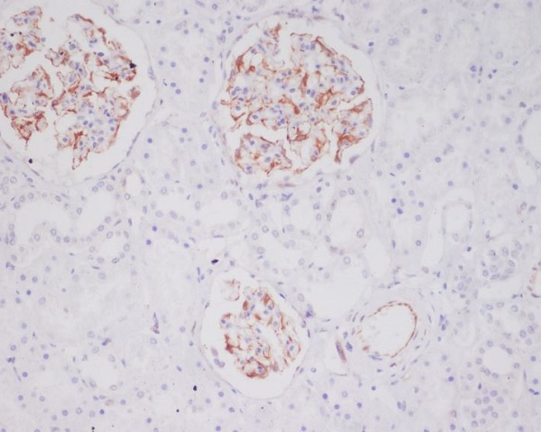 Tryptase 1 Ab