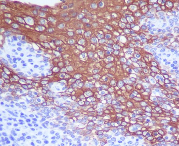 Cytokeratin 13 Ab