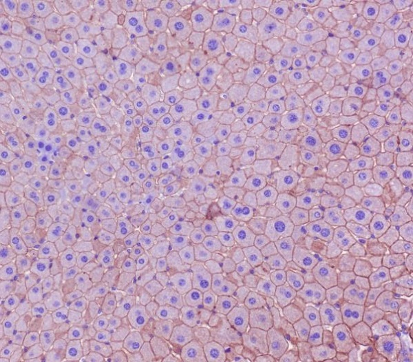 Cytokeratin 18 Ab