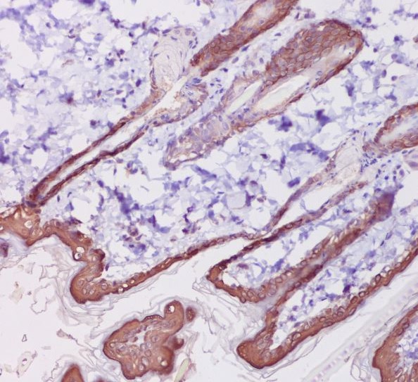 Cytokeratin 1 Ab