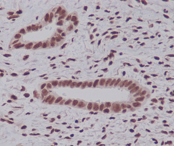 K48-linkage specific ubiquitin Ab