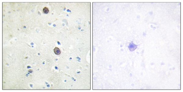 p-Amyloid beta A4 (T743) Ab