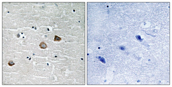 p-CaMKII beta/gamma/delta (T287) Ab