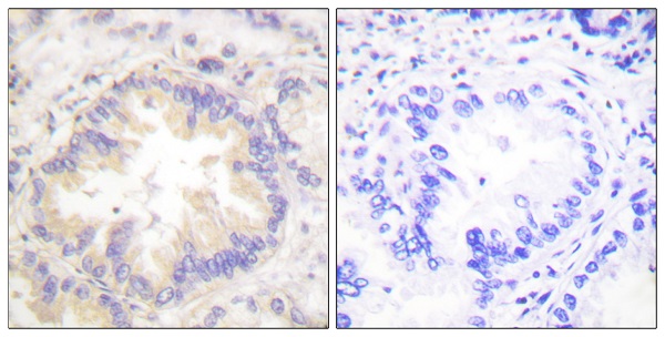 p-Caspase 9 (T125) Ab