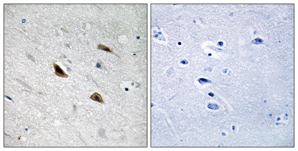 p-beta Catenin (Y489) Ab