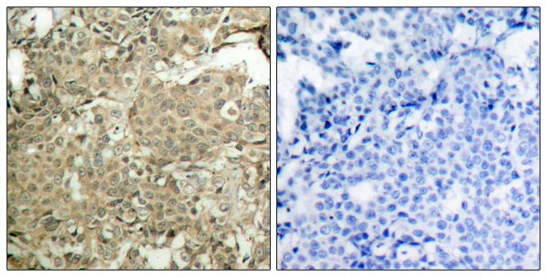 p-Cofilin (S3) Ab