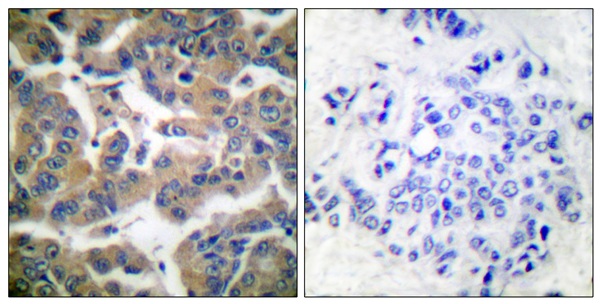 p-Glucocorticoid receptor (S211) Ab