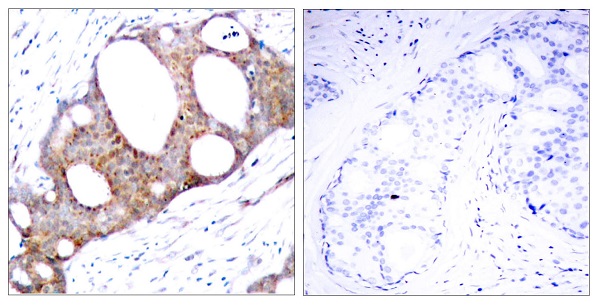 p-GSK3 alpha (S21) Ab