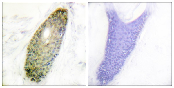 p-HDAC3 (S424) Ab